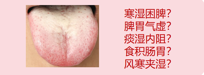 舌苔白腻的5种情况，教你5种方法对症调