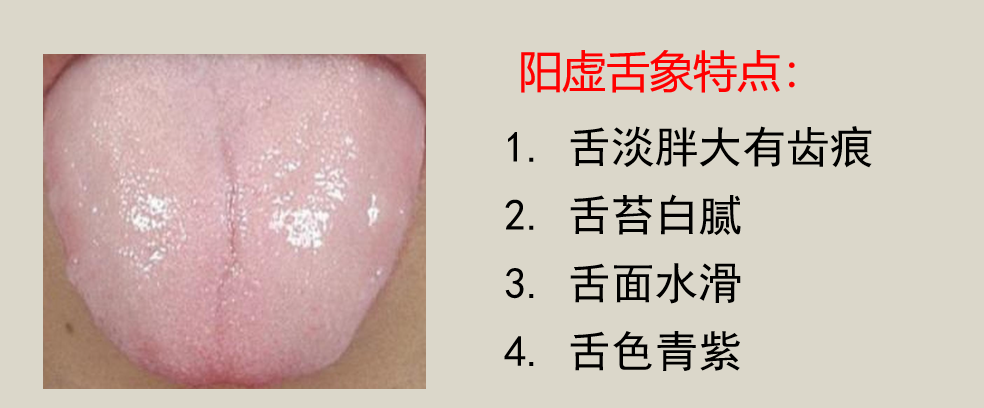 李忠教授：阳气不足可从舌头上看出来！教大家10个升阳气的方法